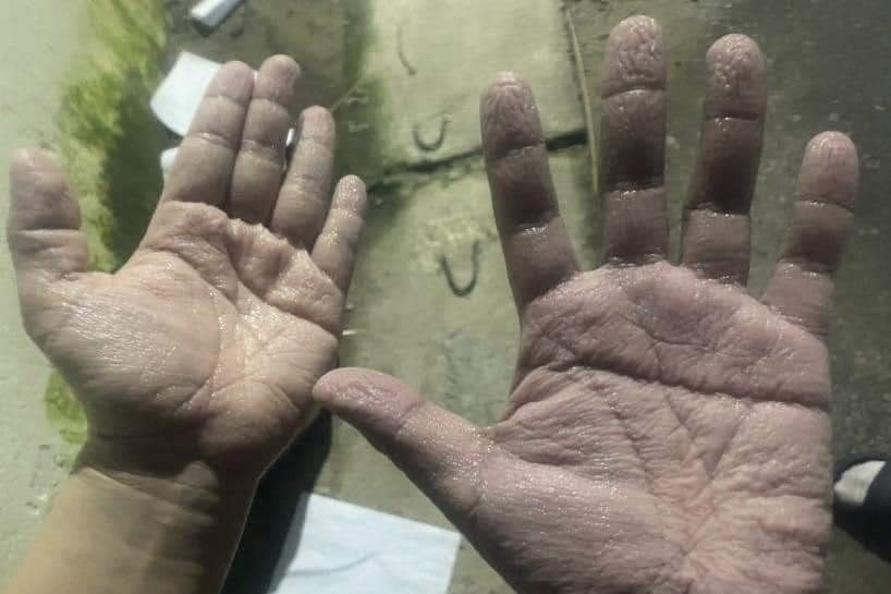 Ban tay nhan vien y te o Bac Giang nhan nheo vi deo gang lien tuc hinh anh