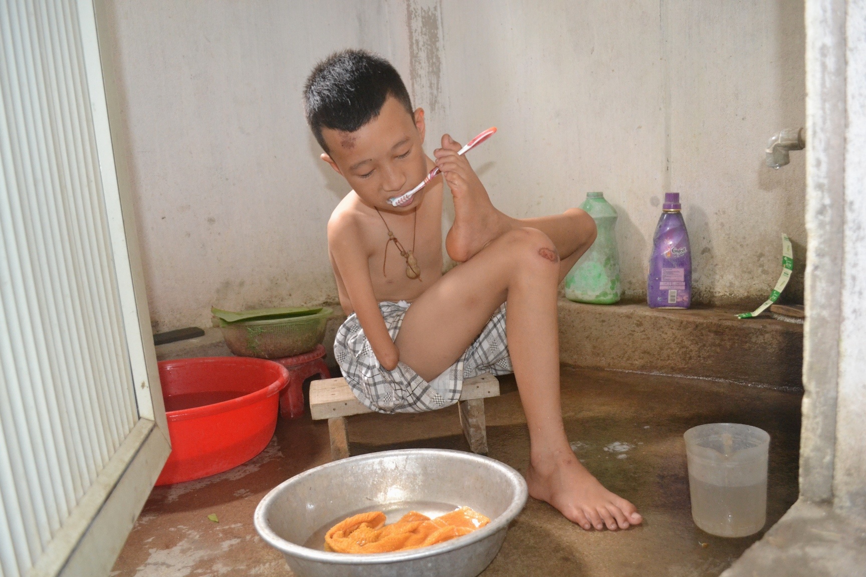 Cuoc song cua cau be khau khinh khong tay o Thanh Hoa hinh anh