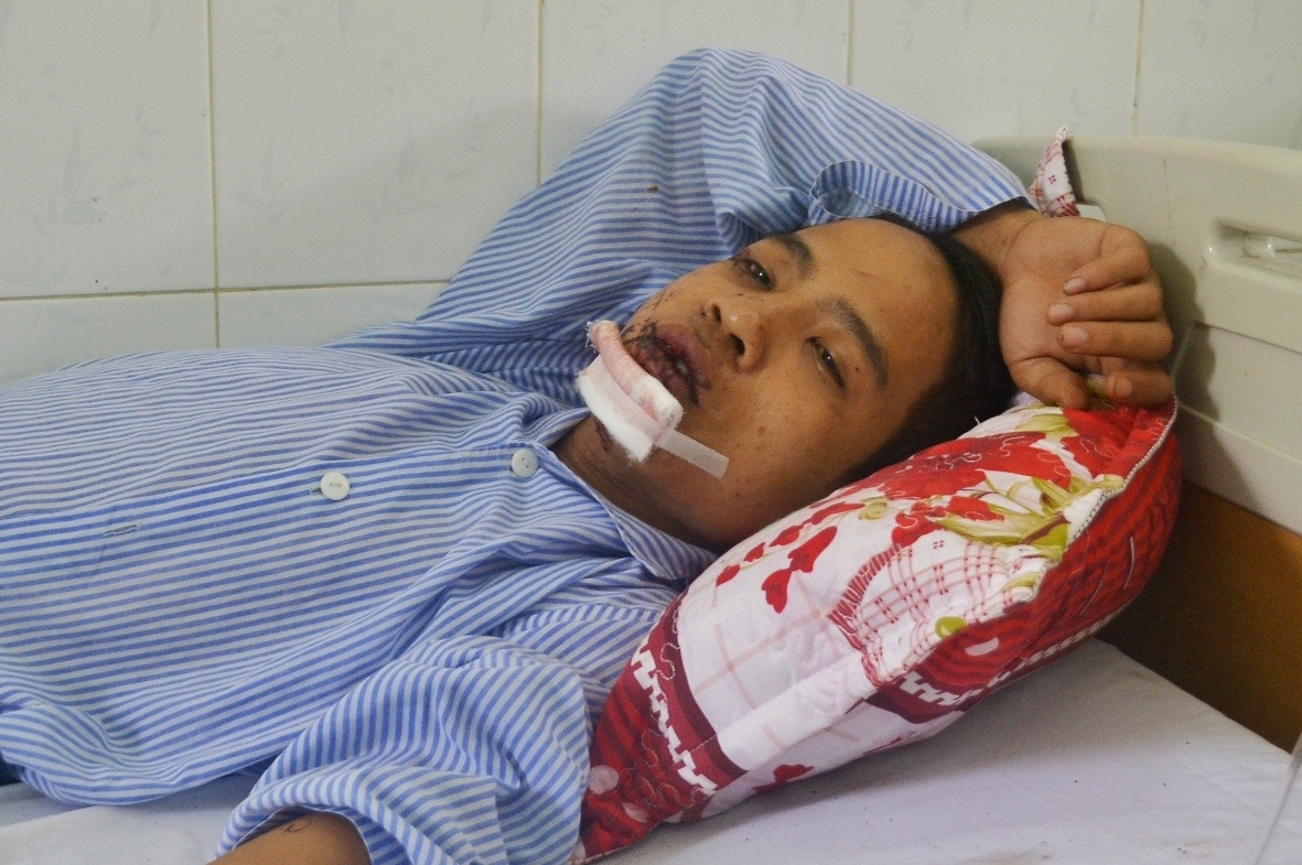 Sức khỏe của chú rể Lê Văn Tuấn gặp nạn trong ngày cưới đang dần hồi phục, tiến triển tốt. Ảnh: Nguyễn Dương.