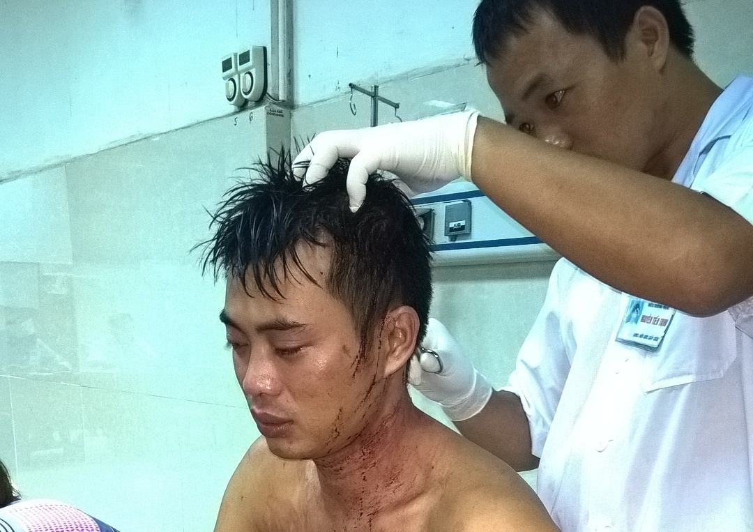 Thanh nien bi con do danh chem khi ngoi uong bia hinh anh