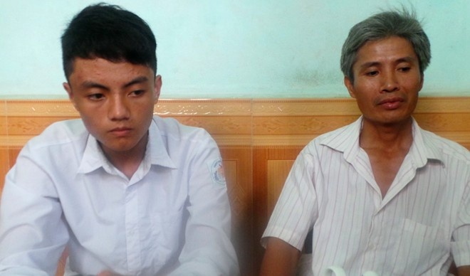 Nam sinh co 2 qua than mot ben duoc goi hoc he quan su hinh anh