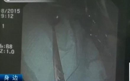 Cuu co gai nuot thia vao bung hinh anh
