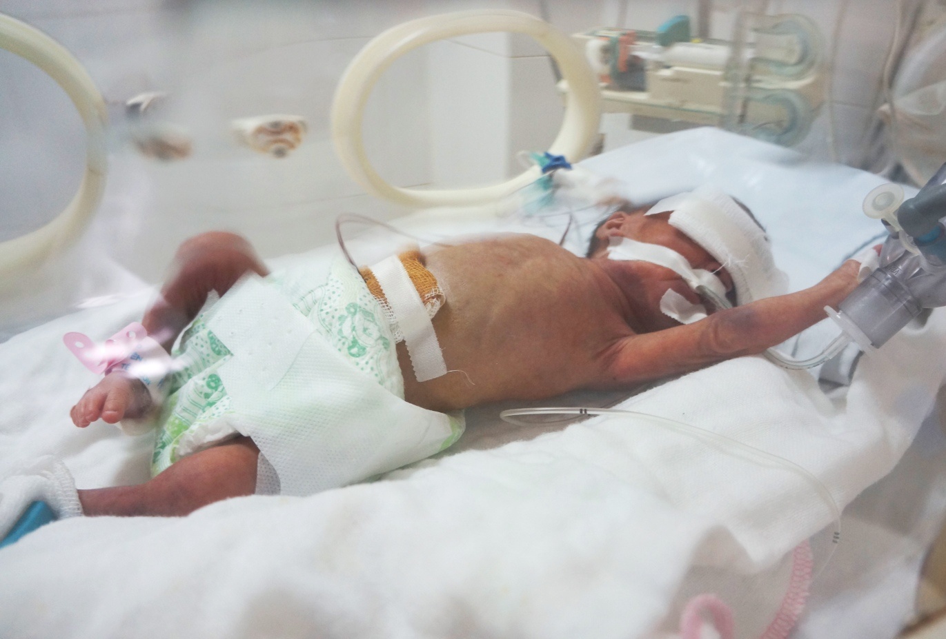 Be so sinh suyt bi chon song dang nguy kich hinh anh