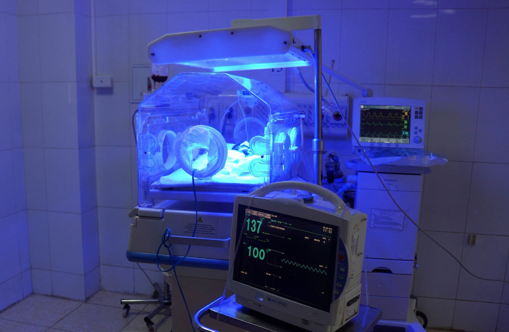 be so sinh suyt bi chon song anh 1