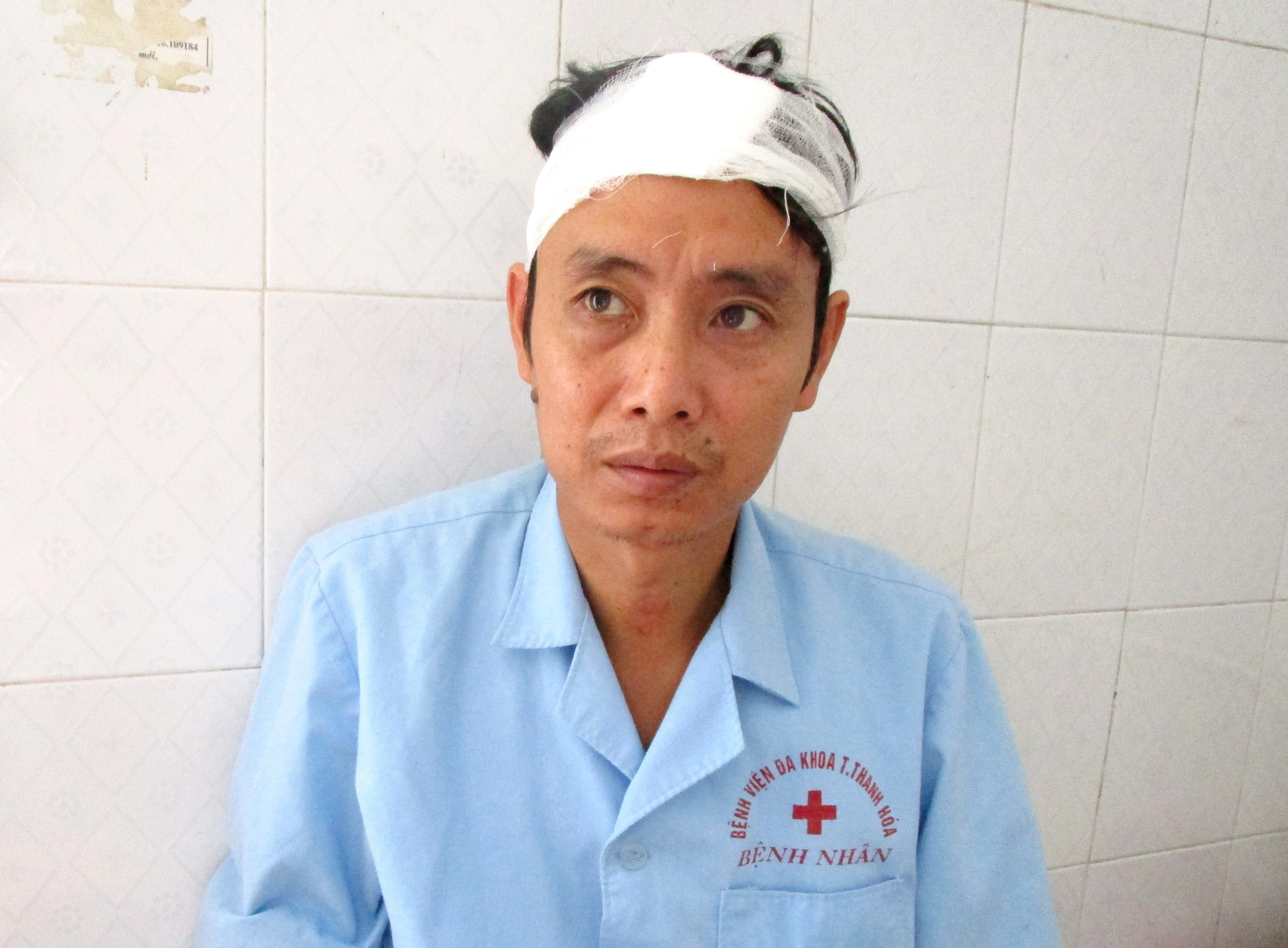 Hai ke bit mat danh nam cong nhan nhap vien hinh anh