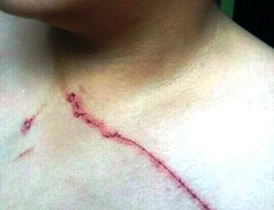 Thay giao tat, da vao bung nam sinh lop 8 hinh anh