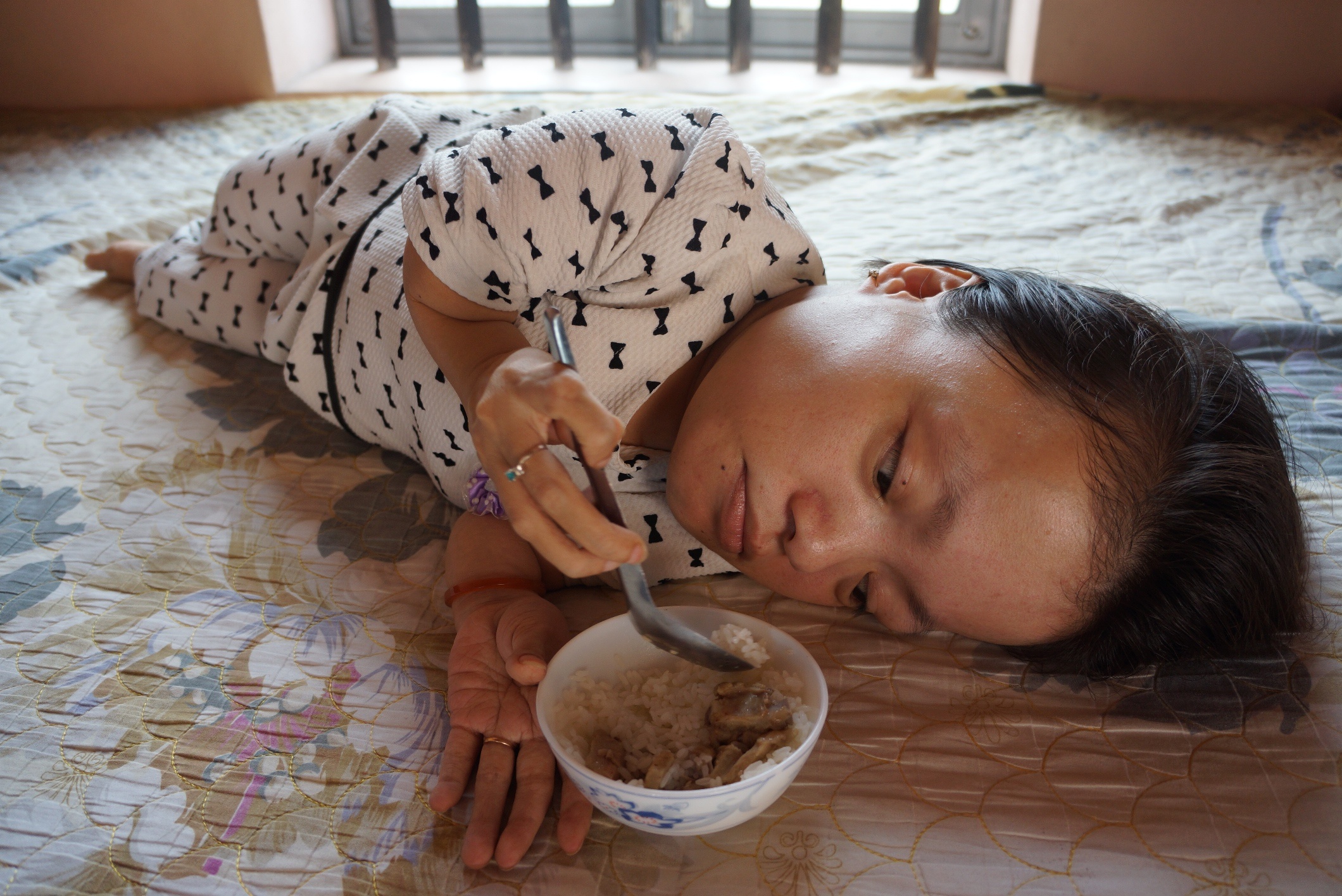 Nghi luc cua co gai cao 90 cm, nang 18 kg bi bai liet tu nho hinh anh