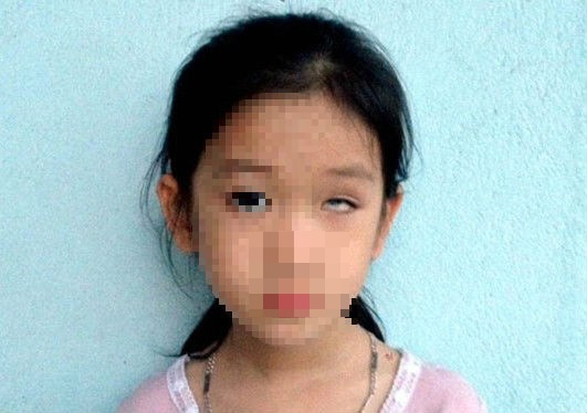 Bao cao Bo GD&DT vu be gai lop mot bi nem mu mat tai truong hinh anh