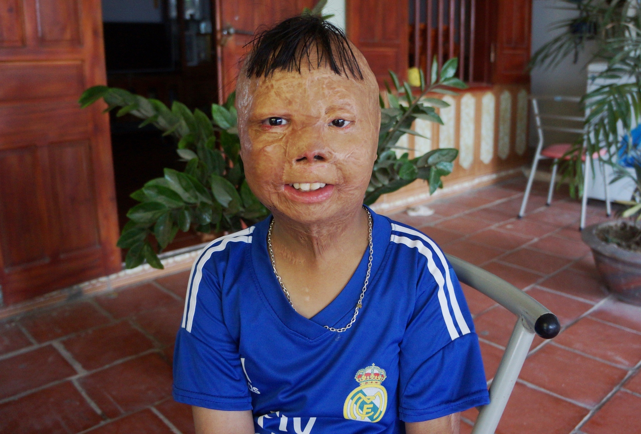 cau be bi cha tam xang dot anh 1