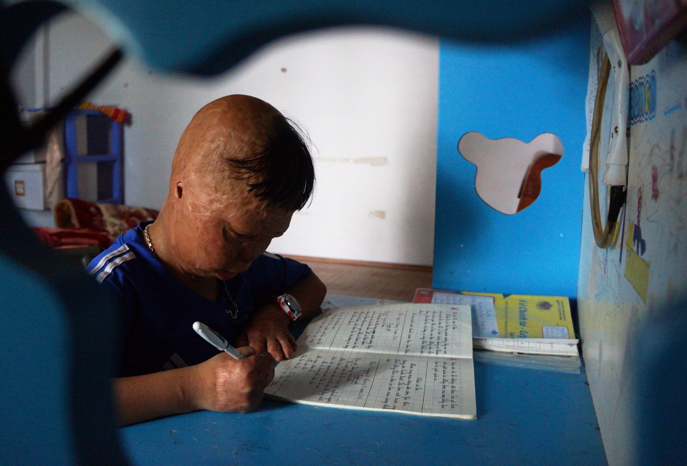 cau be bi cha tam xang dot anh 4