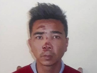 Ga dan ong dam trong thuong nguoi tinh hinh anh