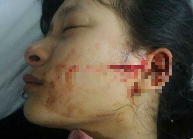 Nu sinh lop 11 bi dam rach mat vi mau thuan o cho hinh anh