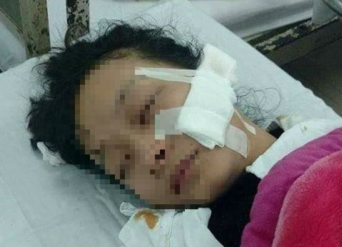 Khoi to vu nu sinh lop 11 bi rach mat o cho hinh anh