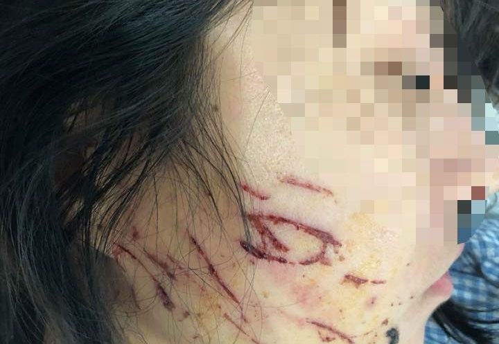 Nu chu tiem spa bi lot do: 'Toi khong quan he ngoai luong' hinh anh