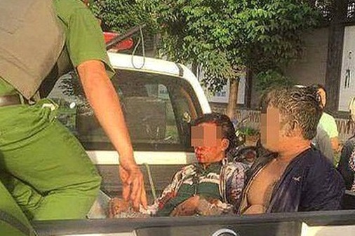 Ba cong an bi phoi nhiem HIV sau khi khong che ke trom cho hinh anh