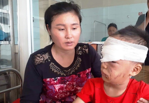 bé trai bị chó cắn ảnh 1 be trai bi cho can anh 1