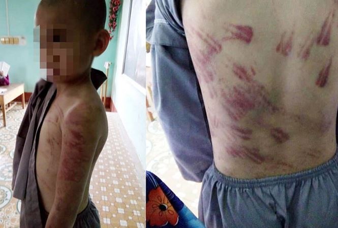 Be trai bi su thay danh tham tim toan than hinh anh