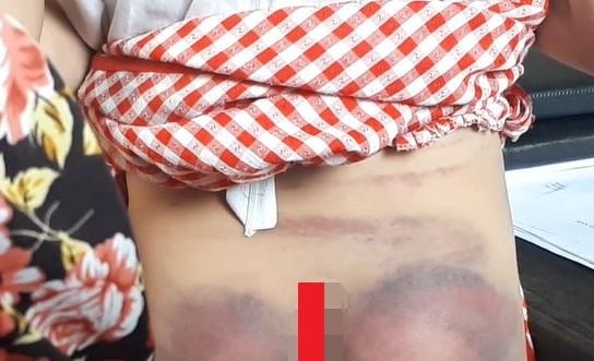 Bi phat 2,5 trieu dong vi danh con gai 8 tuoi bam tim khap nguoi hinh anh