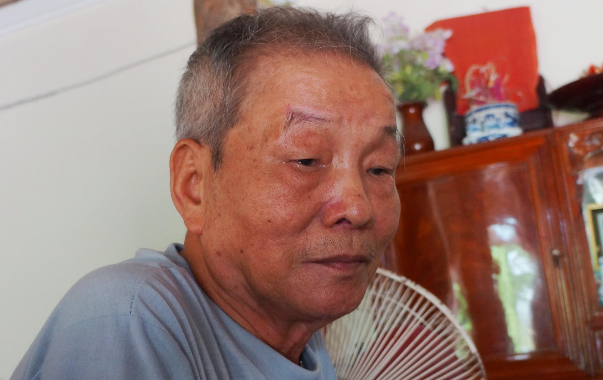 co gai mat tich anh 1