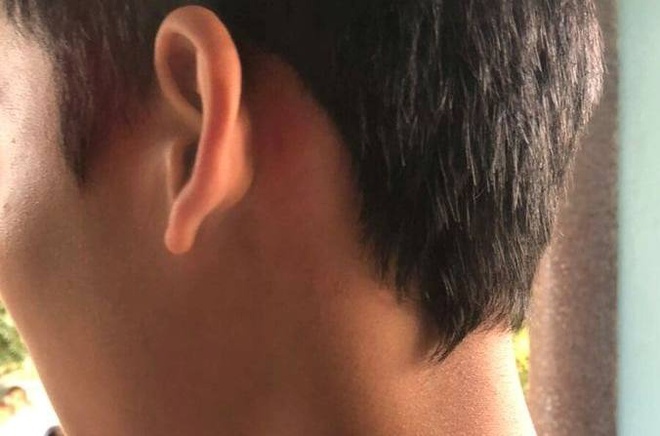 Phat tien nhom nguoi xong vao truong danh nam sinh lop 8 hinh anh