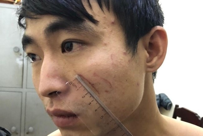 Khoi to ga sat hai nguoi yeu trong nha nghi hinh anh