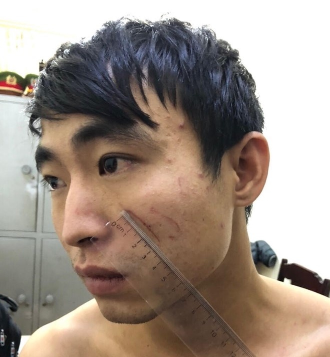 khởi tố kẻ sát hại người yêu ảnh 1 khoi to ke sat hai nguoi yeu anh 1