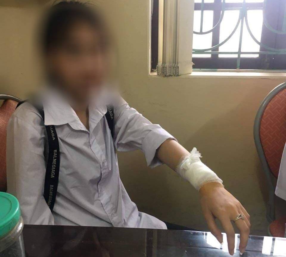 rach tay nu sinh anh 2