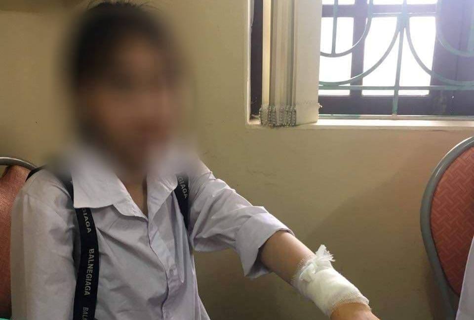 Nam thanh nien dung dao rach tay nu sinh de treu dua hinh anh