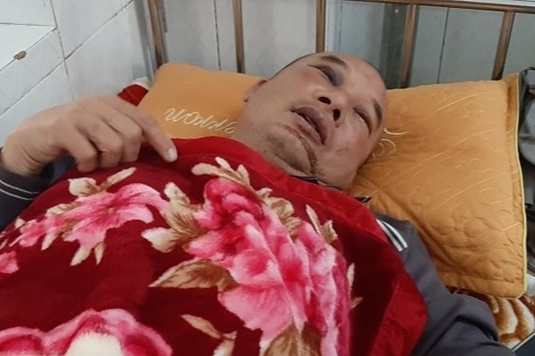 Tai xe taxi bi cuop siet co hinh anh