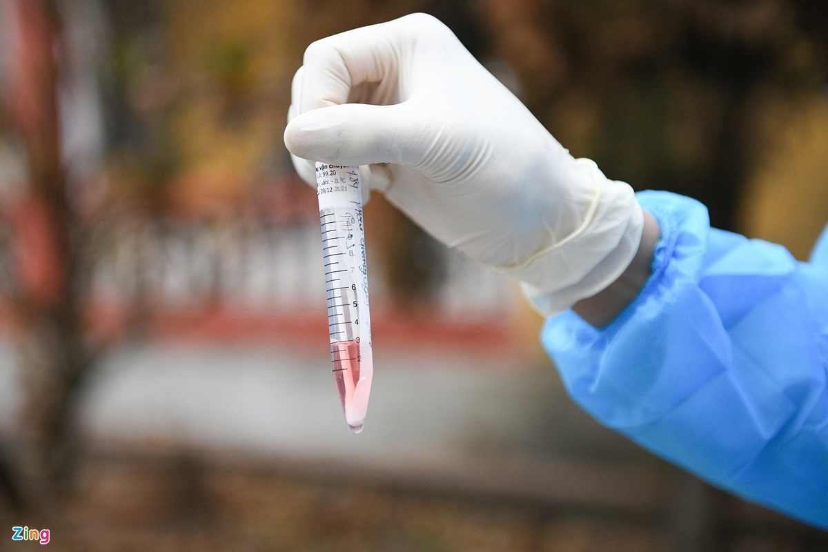 2 nu nhan vien karaoke duong tinh anh 1