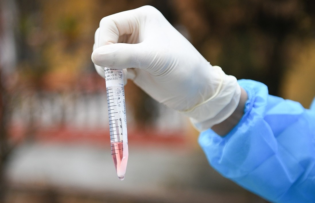 Hai Phong xet nghiem Covid-19 cho cac ho dan song gan khach san Paris hinh anh