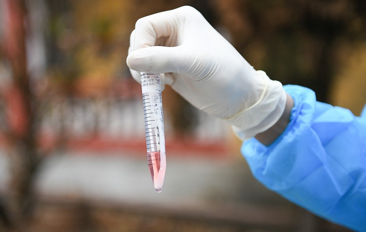 Hai Duong khan cap lay mau xet nghiem anh 1