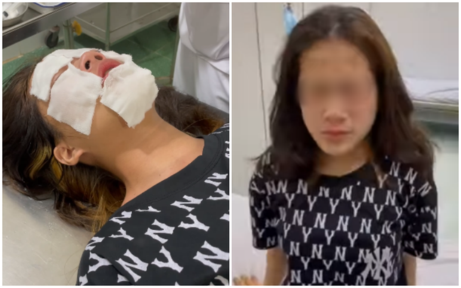 nu sinh bi xit hoi cay anh 2