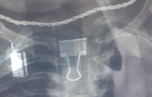 Kep giay mac trong thuc quan be 2 tuoi hinh anh