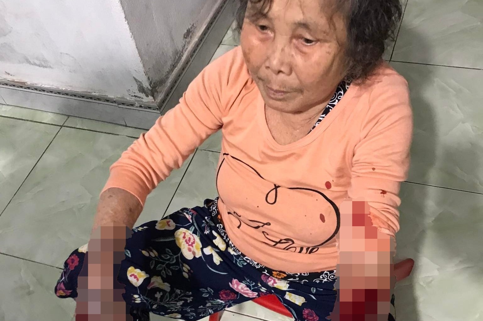 Nhac hang xom mo nhac lon, cu ba 83 tuoi bi danh nhap vien hinh anh