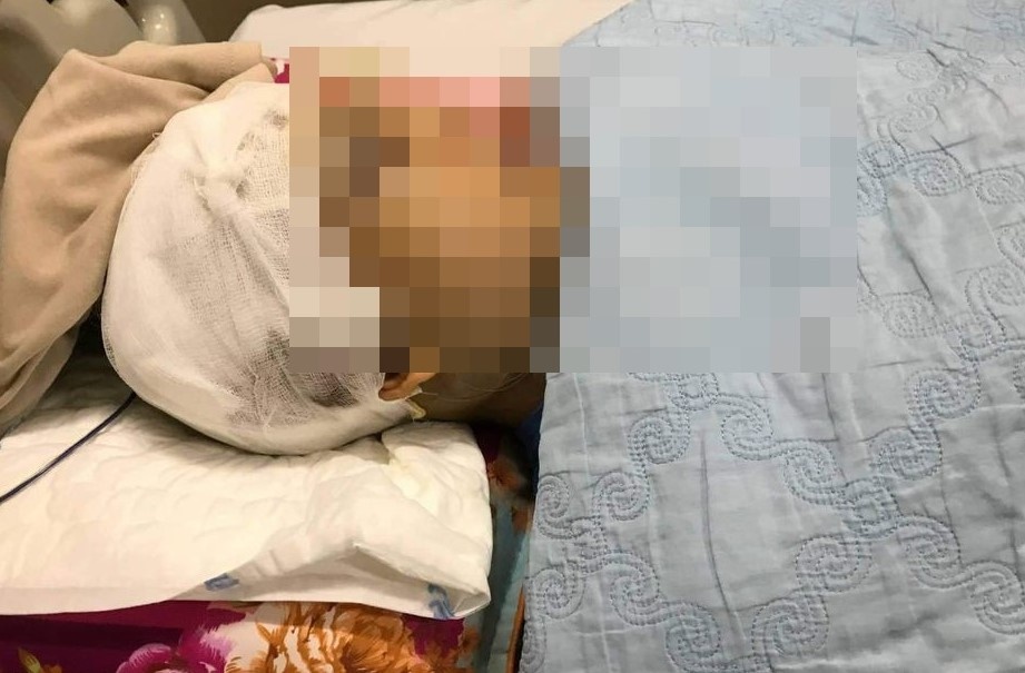 Pho chu tich xa bi danh nut hop so khi ngan hoat dong san lap dat hinh anh