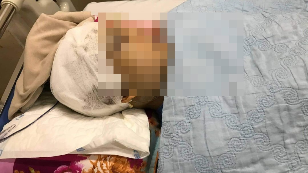 vu pho chu tich xa bi danh anh 1