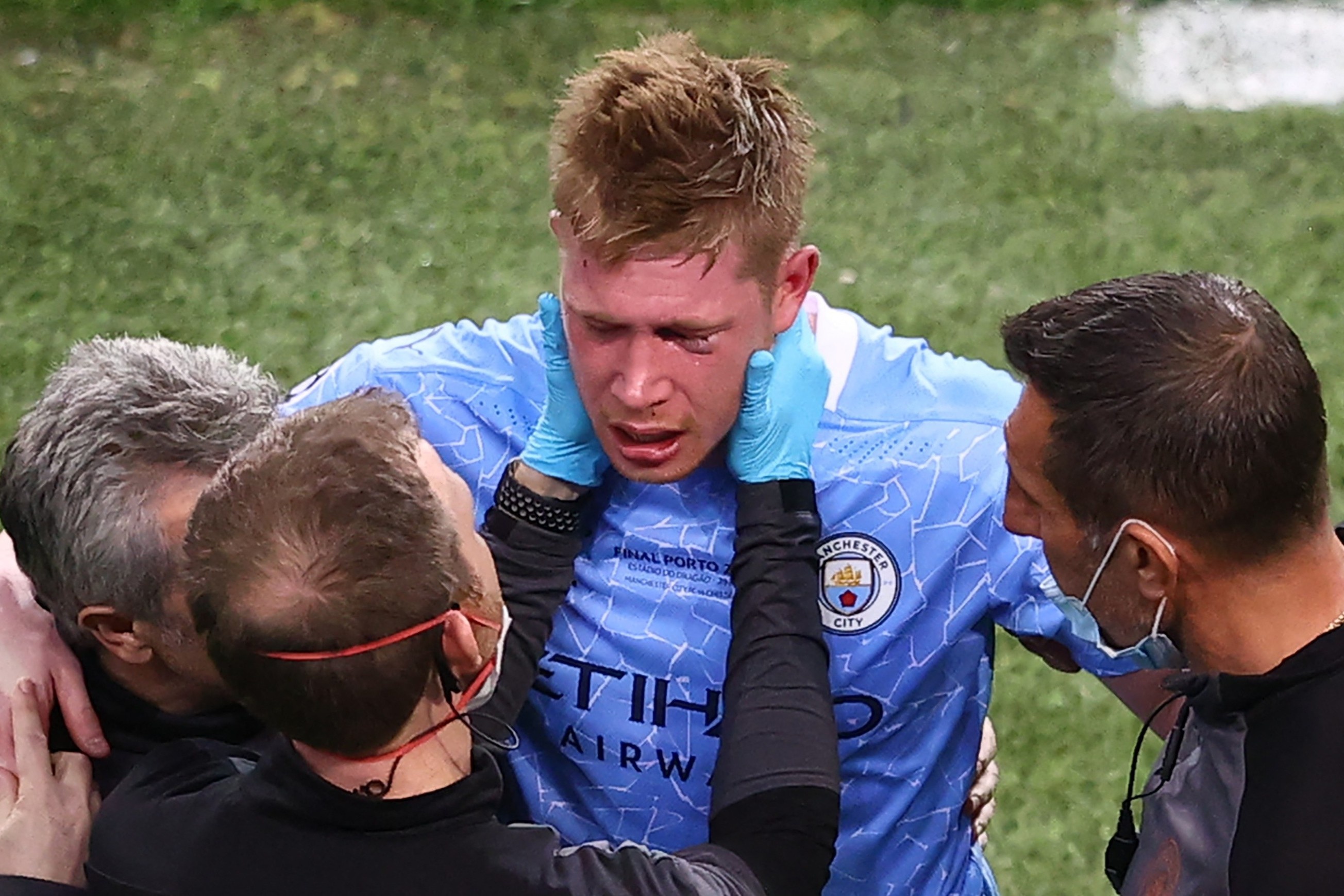 De Bruyne dinh chan thuong nang hinh anh