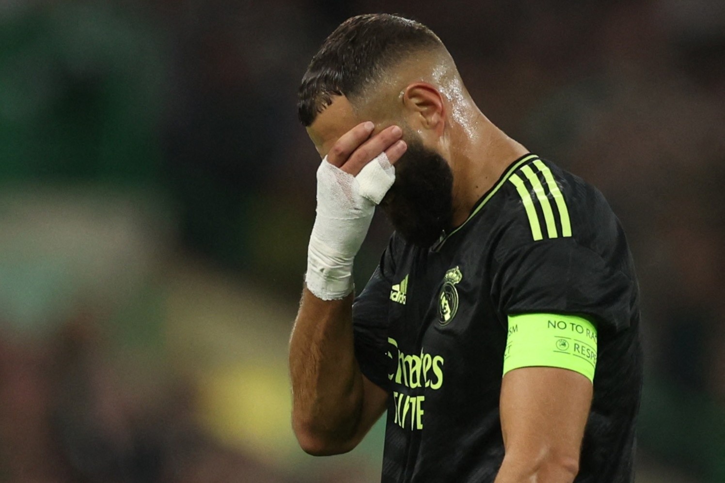 Chan thuong cua Benzema khong nghiem trong hinh anh