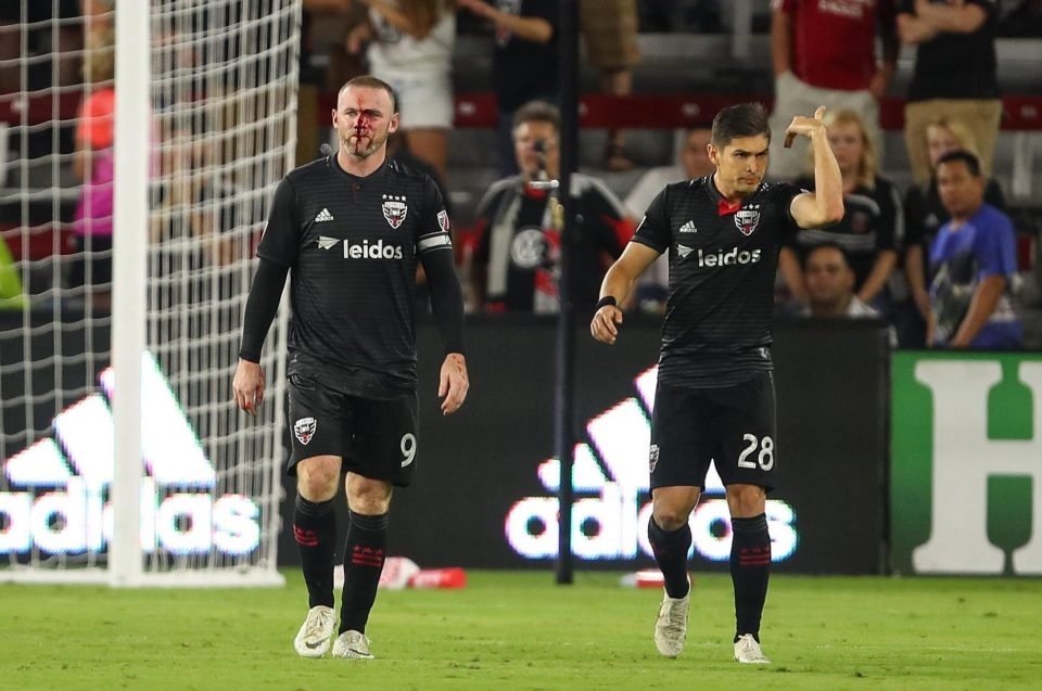 Rooney đầm đìa máu,  Wayne Rooney,  DC United ảnh 1 Rooney dam dia mau,  Wayne Rooney,  DC United anh 1