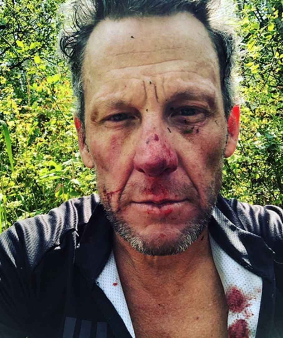 Lance Amstrong gặp tai nạn xe đạp ảnh 1 Lance Amstrong gap tai nan xe dap anh 1