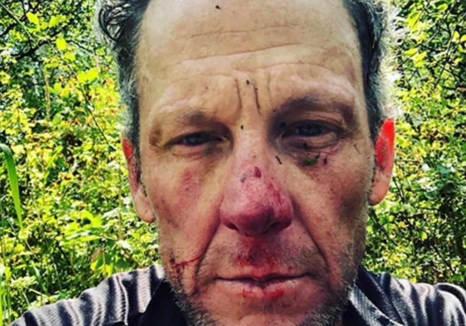 Cuu cua ro Lance Armstrong gap tai nan khi dap xe tren duong mon hinh anh