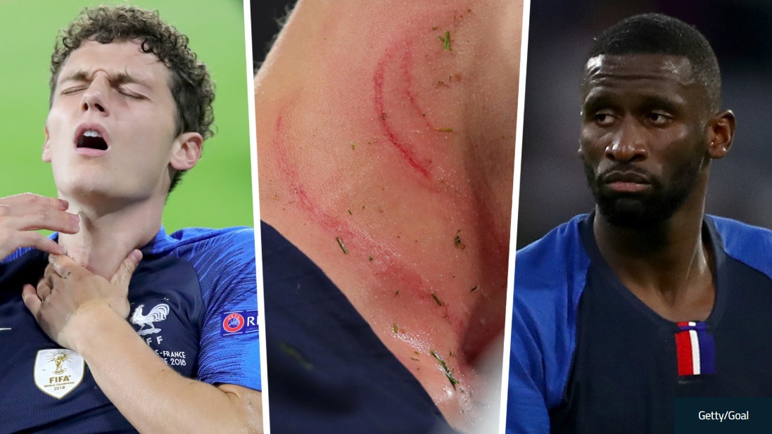 Hau ve Chelsea len tieng sau pha pham loi lam rach co Benjamin Pavard hinh anh