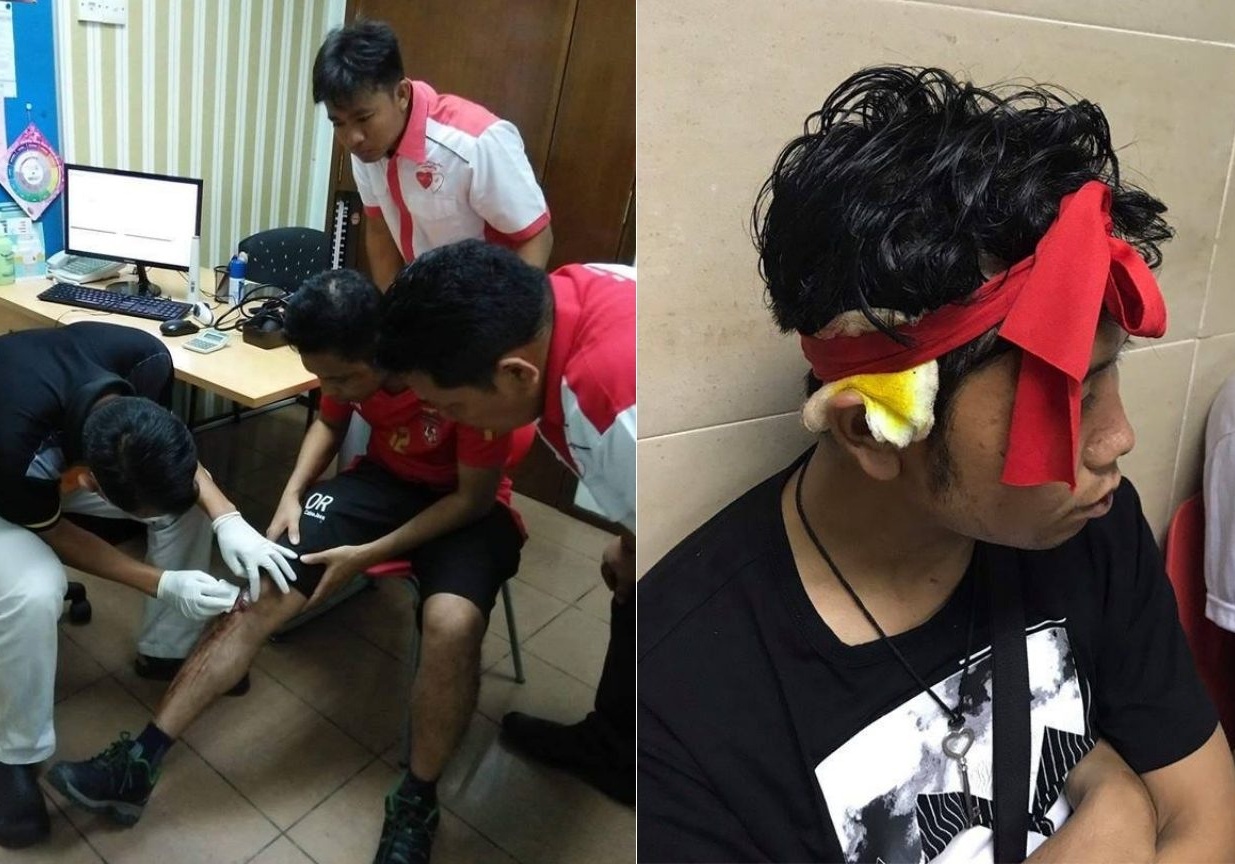 CDV Myanmar bi tan cong o Malaysia du doi nha thua cuoc hinh anh