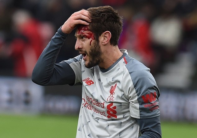 Adam Lallana do mau trong ngay Liverpool len dau bang Ngoai hang Anh hinh anh