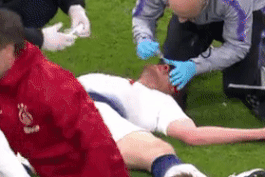 Vertonghen do mau mui, non oe khi co thi dau sau pha va cham manh hinh anh