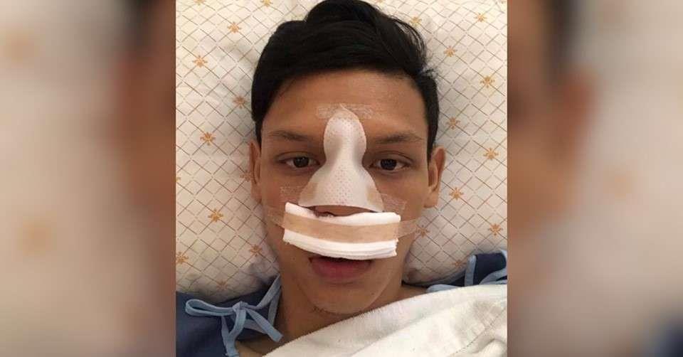 cầu thủ đấm Đình Trọng, Supachai Jaided vỡ mũi, Buriram United, Chiangmai, Thai League ảnh 1 cau thu dam Dinh Trong, Supachai Jaided vo mui, Buriram United, Chiangmai, Thai League anh 1