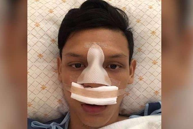 Dong doi Xuan Truong bi gay mui trong tran thang cua Buriram hinh anh