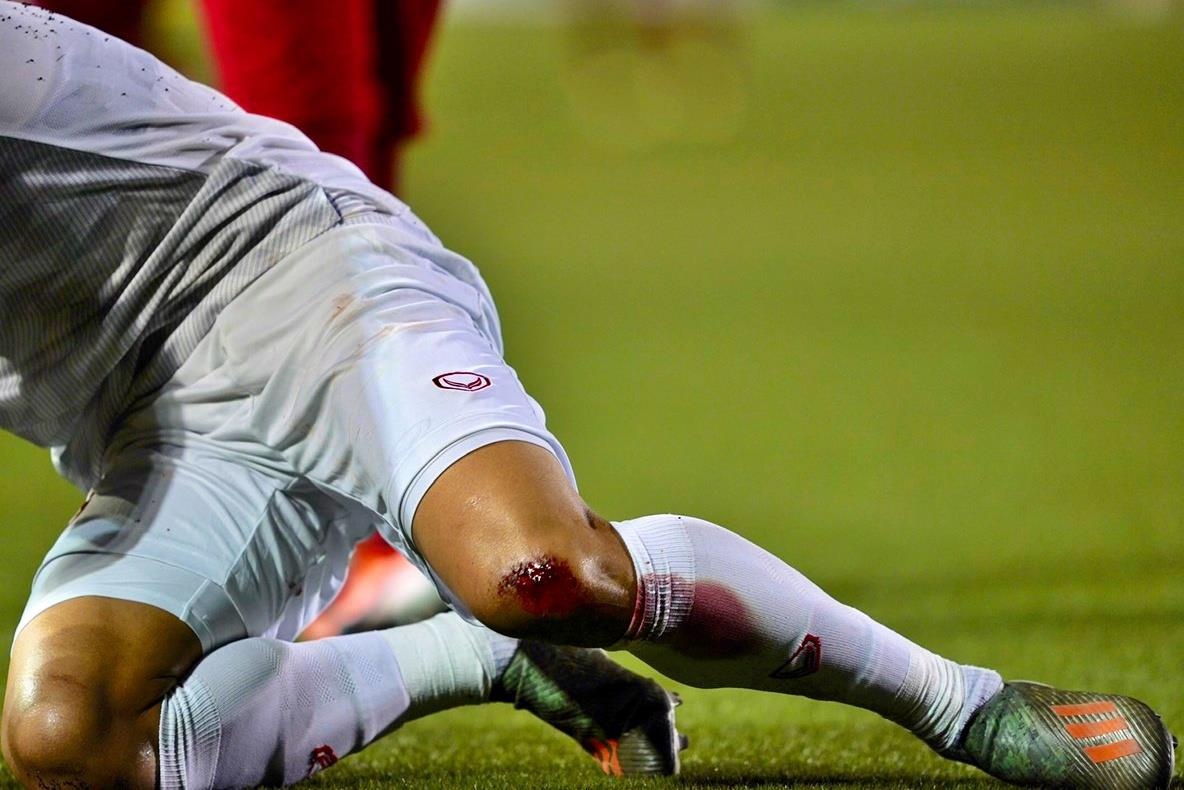 Van Hau chay mau dau goi truoc khi ghi ban vao luoi Indonesia hinh anh