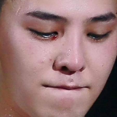 Vết xước ở phần khóe mắt của G-Dragon.